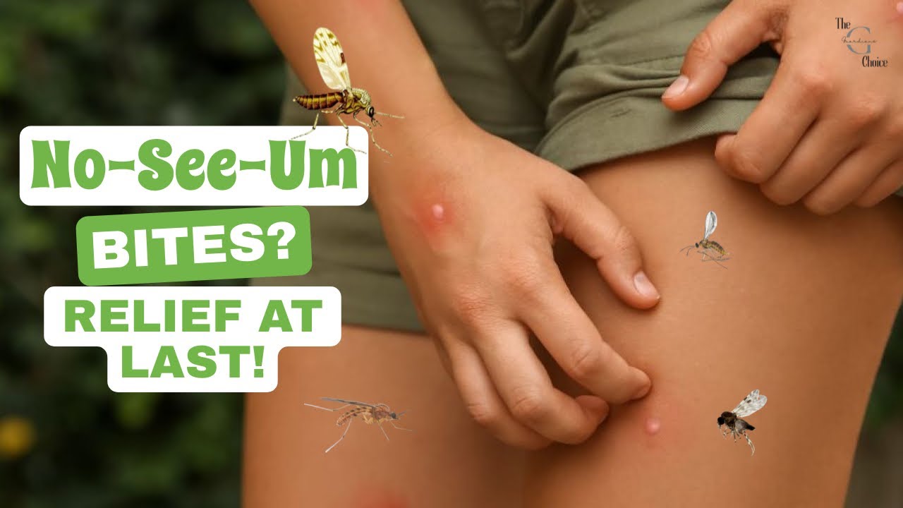 Treating No-See-Um Bites: Simple Home Remedies to Try
